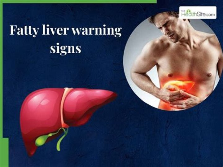 20 Liver Warning Signs You Can't Afford to Ignore— Best Life