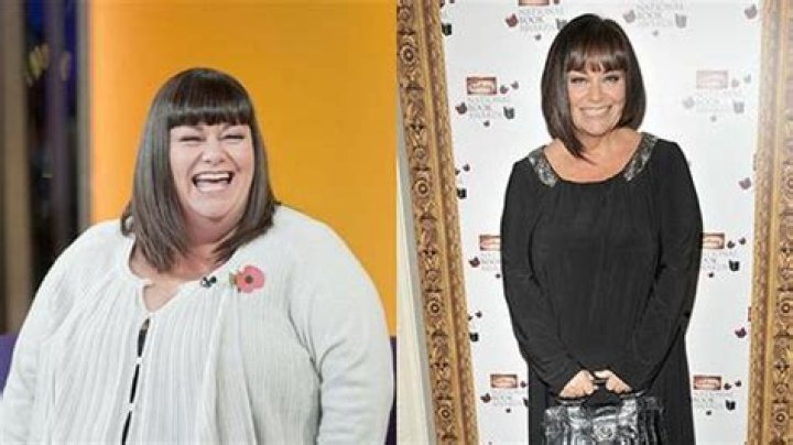 Dawn French Weight Loss – Lost Massive Seven and Half Stone