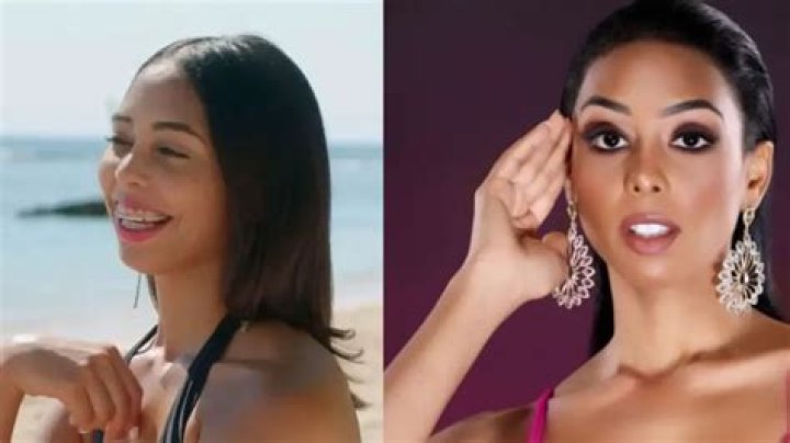 Did She Remove Her Braces?