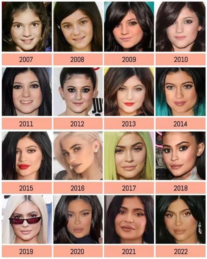 Has Kylie Jenner Had Plastic Surgery?
