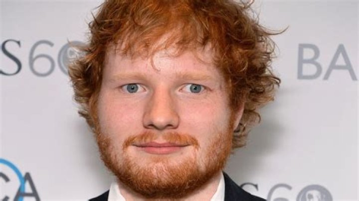Is Ed Sheeran Cross Eyed?