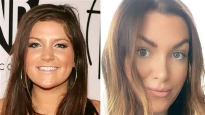 Laguna Beach Star’s Transformation Is The Result Of Her Cheek Reduction, Nose Job, And More!